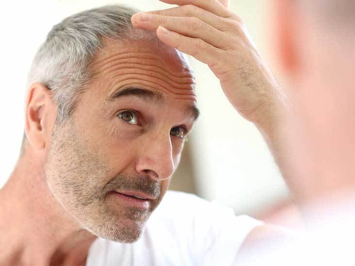 The Effects of Stress on Your Hair Transplant Results